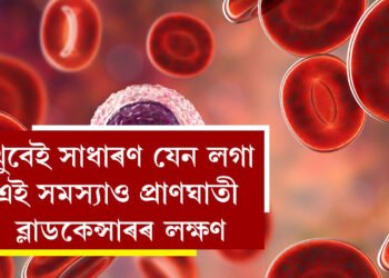 এইসমূহেই ব্লাড কেন্সাৰৰ প্ৰাথমিক লক্ষণ! খুবেই সাধাৰণ যেন লগা এই সমস্যাও প্ৰাণঘাতী হ’ব পাৰে, দেশত কিয় বাঢ়িছে ব্লাড কেন্সাৰত আক্ৰান্তৰ সংখ্যা?