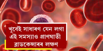 এইসমূহেই ব্লাড কেন্সাৰৰ প্ৰাথমিক লক্ষণ! খুবেই সাধাৰণ যেন লগা এই সমস্যাও প্ৰাণঘাতী হ’ব পাৰে, দেশত কিয় বাঢ়িছে ব্লাড কেন্সাৰত আক্ৰান্তৰ সংখ্যা?