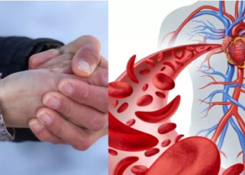 হাত-ভৰি সকলো সময়তে ঠাণ্ডা থাকে? সাৱধান শৰীৰত লুকাই থাকিব পাৰে এইসমূহ মাৰাত্মক ৰোগ