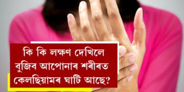 শৰীৰত কেলছিয়ামৰ অভাৱ হ’লে কি কি ৰোগে দেখা দিব পাৰে? কি কি লক্ষণ দেখিলে বুজিব আপোনাৰ শৰীৰত কেলছিয়ামৰ ঘাটি আছে?