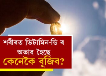 শৰীৰত ভিটামিন ডিৰ অভাৱ হৈছে, কেনেকৈ বুজিব?