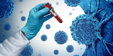 দৈনন্দিন কি কি অভ্যাসে বঢ়াই তোলে কৰ্কটক আশংকা? জানি থওক সমূহ ৰিস্ক ফেক্টৰ