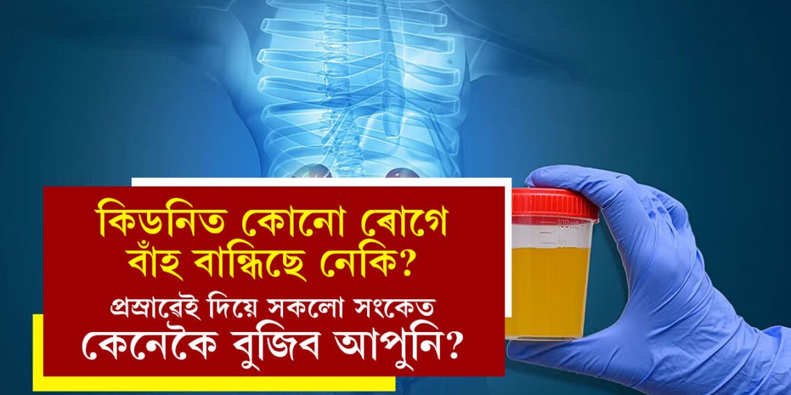 কিডনিত কোনো ৰোগে বাঁহ বান্ধিছে নেকি? প্ৰস্ৰাৱেই দিয়ে সকলো সংকেত, কেনেকৈ বুজিব আপুনি?