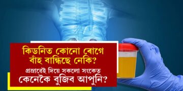 কিডনিত কোনো ৰোগে বাঁহ বান্ধিছে নেকি? প্ৰস্ৰাৱেই দিয়ে সকলো সংকেত, কেনেকৈ বুজিব আপুনি?