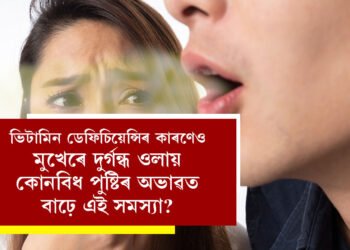 দাঁতৰ সমস্যাৰ বাবে নহয়, ভিটামিন ডেফিচিয়েন্সিৰ কাৰণেও মুখত দুৰ্গন্ধ ওলায়, কোনবিধ পুষ্টিৰ অভাৱত বাঢ়ে এই সমস্যা?
