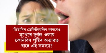দাঁতৰ সমস্যাৰ বাবে নহয়, ভিটামিন ডেফিচিয়েন্সিৰ কাৰণেও মুখত দুৰ্গন্ধ ওলায়, কোনবিধ পুষ্টিৰ অভাৱত বাঢ়ে এই সমস্যা?