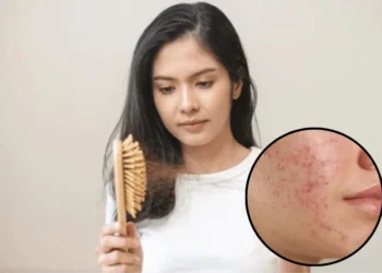 অত্যাধিক চুলি সৰা আৰু ছালৰ সমস্যা, ই কি ৰোগৰ ইংগিত?