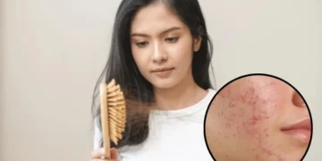 অত্যাধিক চুলি সৰা আৰু ছালৰ সমস্যা, ই কি ৰোগৰ ইংগিত?