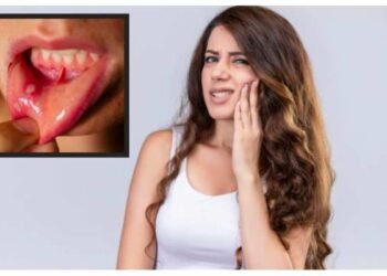 সঘনাই মুখত ঘাঁ হৈছে নেকি? নকৰিব আওকাণ