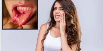 সঘনাই মুখত ঘাঁ হৈছে নেকি? নকৰিব আওকাণ