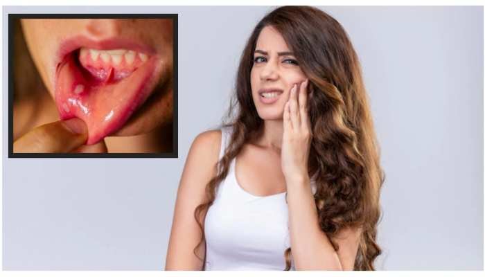 সঘনাই মুখত ঘাঁ হৈছে নেকি? নকৰিব আওকাণ