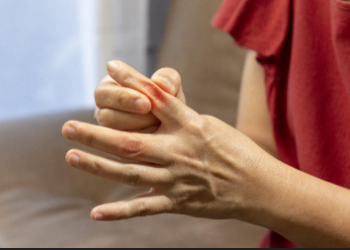 ইউৰিক এছিডৰ মহৌষধ এই ৪ খাদ্য, খালেই দূৰ হ’ব গাঁঠিৰ বিষ