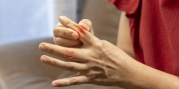 ইউৰিক এছিডৰ মহৌষধ এই ৪ খাদ্য, খালেই দূৰ হ’ব গাঁঠিৰ বিষ