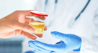 প্ৰস্ৰাৱত ফেন দেখিছে? গুৰুত্বসহকাৰে লওক, অন্যথা এই মহাবিপদ আহিব পাৰে আপোনাৰো