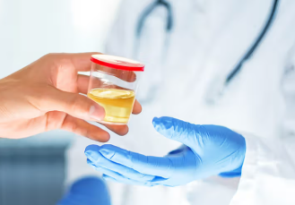 প্ৰস্ৰাৱত ফেন দেখিছে? গুৰুত্বসহকাৰে লওক, অন্যথা এই মহাবিপদ আহিব পাৰে আপোনাৰো