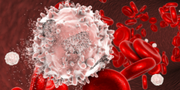 এইসমূহেই ব্লাড কেন্সাৰৰ প্ৰাথমিক লক্ষণ! খুবেই সাধাৰণ যেন লগা এই সমস্যাও প্ৰাণঘাতী হ’ব পাৰে, দেশত কিয় বাঢ়িছে ব্লাড কেন্সাৰত আক্ৰান্তৰ সংখ্যা?