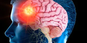 ব্ৰেইন ষ্ট্ৰোক কিয় হয়, প্ৰথম লক্ষণ দেখিলে কি কি কৰিব?