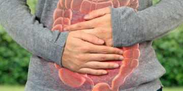 কলনত কিমান সময় মল জমা থাকিলে কোষ্ঠকাঠিন্য হ’ব পাৰে? কেতিয়া বাঢ়ে কলনৰ কৰ্কটৰ আশংকা?