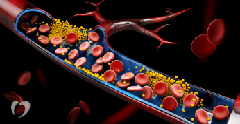 এই ৩খাদ্যই বঢ়াই বেয়া কলষ্টেৰল, বঢ়াই হৃদৰোগৰ আশংকা, কি কি খাদ্য এৰাই চলিব?