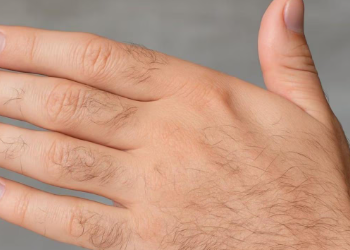 হাতৰ আঙুলিত নোম আছে? শুভ নে অশুভ? মানুহ হিচাপে কেনে হয় এনে ব্যক্তি? হাতৰ এই লক্ষণ চায়েই জানি থওক চৰিত্ৰ