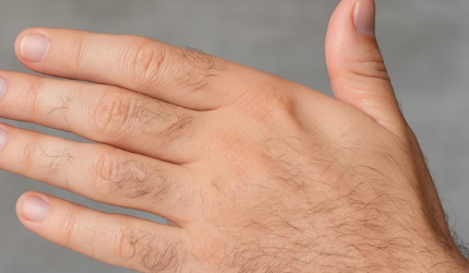 হাতৰ আঙুলিত নোম আছে? শুভ নে অশুভ? মানুহ হিচাপে কেনে হয় এনে ব্যক্তি? হাতৰ এই লক্ষণ চায়েই জানি থওক চৰিত্ৰ