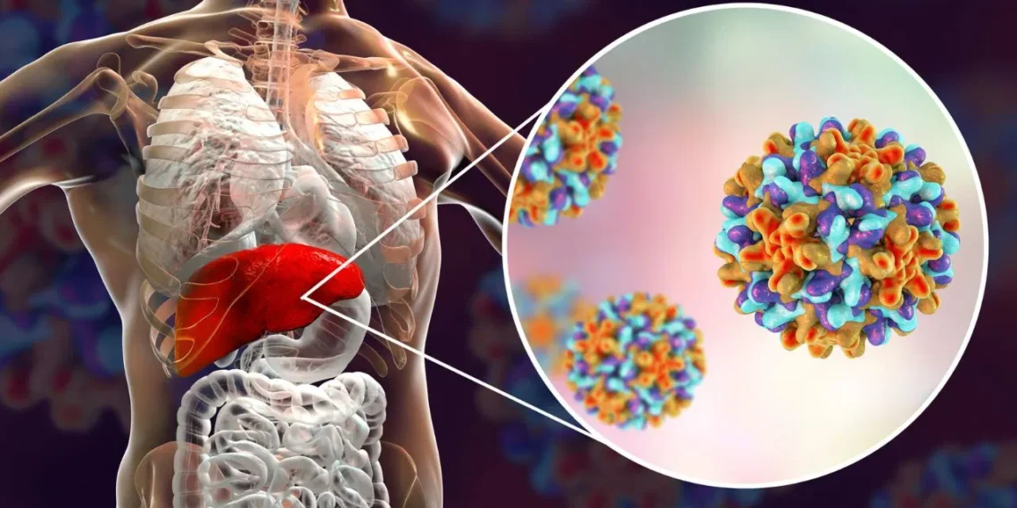 সঘনাই যকৃতৰ সংক্ৰমণ, এয়া দুৰাৰোগ্য ৰোগৰ লক্ষণ নেকি?