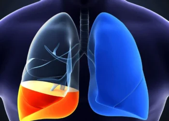 হাওঁফাওঁত পানী জমা, কিমান বিপদজনক এই সমস্যা?