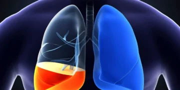 হাওঁফাওঁত পানী জমা, কিমান বিপদজনক এই সমস্যা?