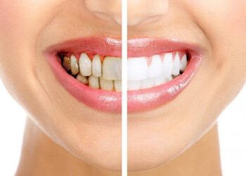 ব্ৰাছ কৰাৰ সঠিক পদ্ধতি, ভুল কৰিলে বিপদ অনিবাৰ্য!