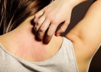 বাৰে বাৰে এলাৰ্জীয়ে অশান্তি কৰিছে নেকি? কেনেকৈ দূৰ কৰিব এই সমস্যা জানক