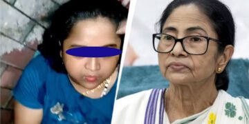 নিজ বাসগৃহৰ সন্মুখতে মমতা বেনাৰ্জীক ছুৰীৰে আক্ৰমণ!